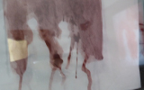 Interval [ ] Still : Now, Tintype, London